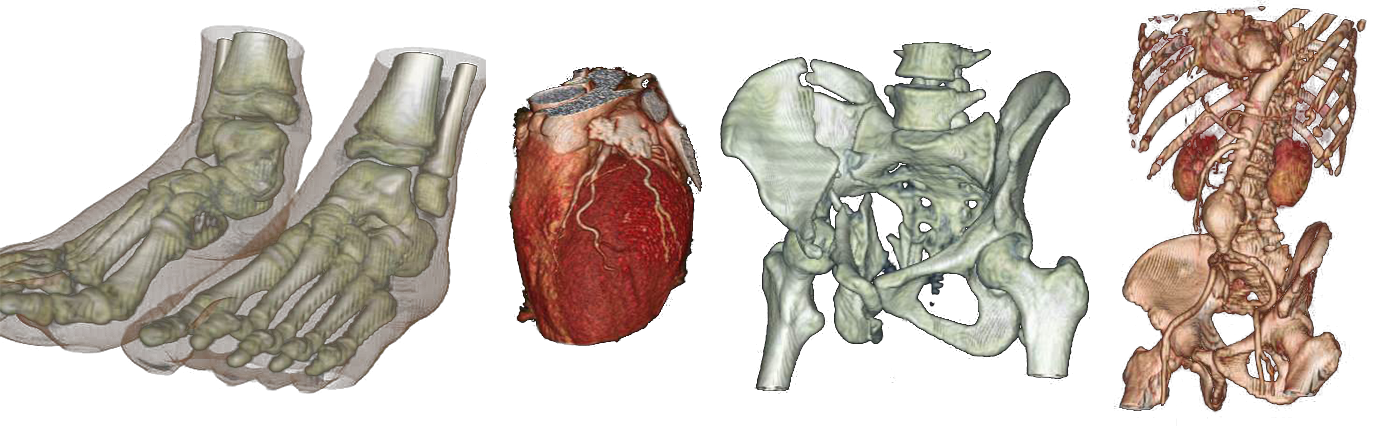 3D Ansicht von Fußknochen, Herz, Beckenknochen und Rumpf