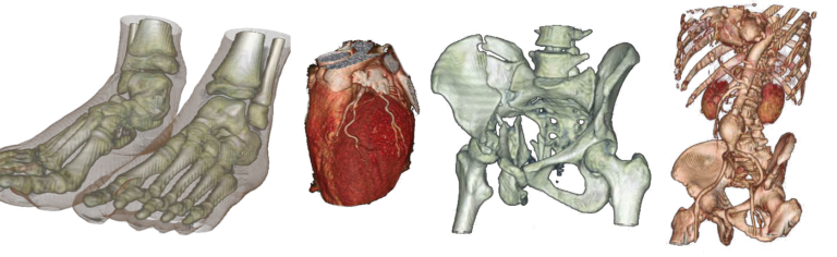 3D renderings of different body parts