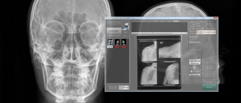 Application screenshot of scangate with a skull x-ray in the background